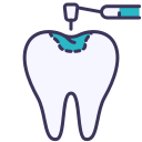 Tooth Filling Treatment Icon - East Vancouver Family Dental Dental fillings and restorative care East Vancouver